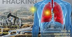 Environmental Health Medicine