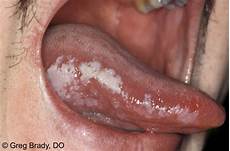 Hiv Medicines