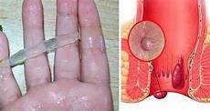 Medicines